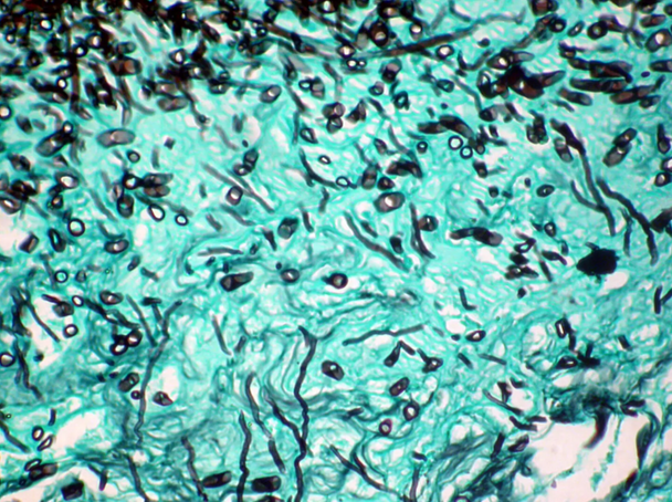 StatLab HCS Fungus Control Slides, non-adhesive slide