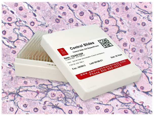 Reticulum Fibers Controls