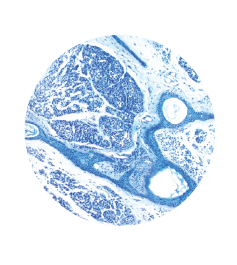 Toluidine Blue 1% Aqueous Frozen