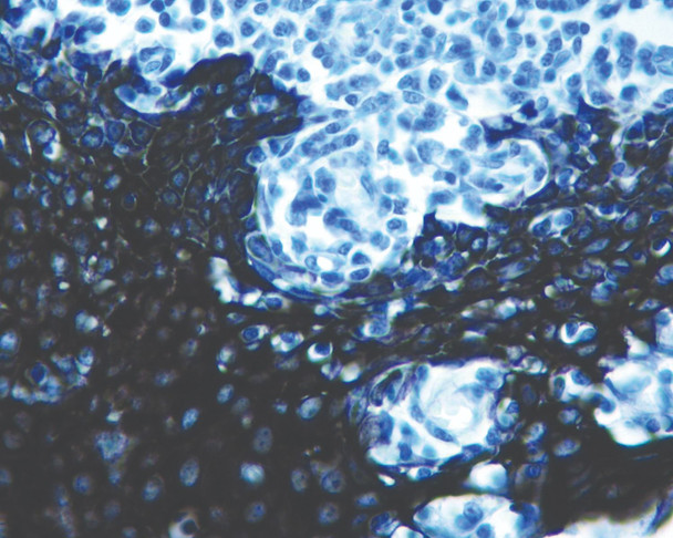 Black HRP Chromogen, Ultra High Def