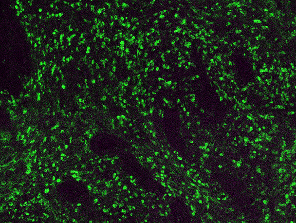 Kappa Light Chain Antibody with FITC Tag