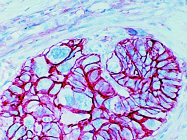 CD44/H-CAM, Clone 156-3C11