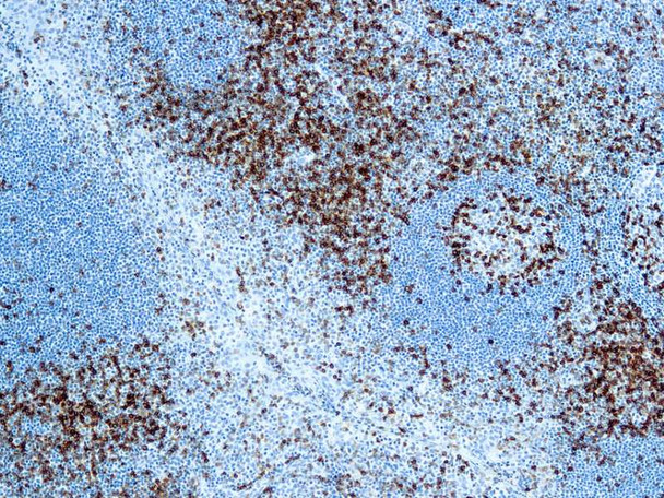 CD45 LCA, Clone 2B11+PD7/26, 10mL