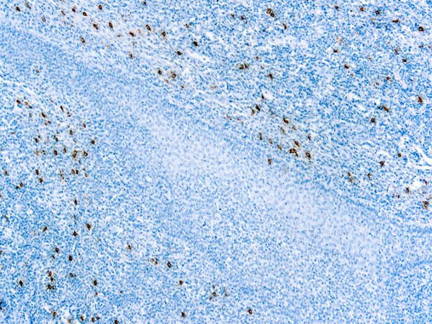 Mast Cell Tryptase, Clone AA1