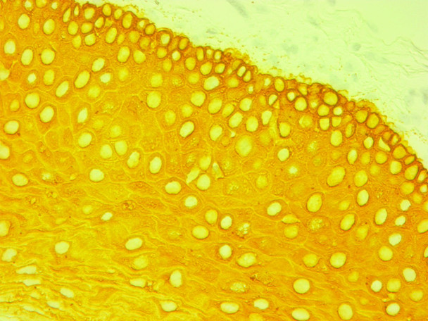 Yellow HRP Chromogen, Ultra High Def