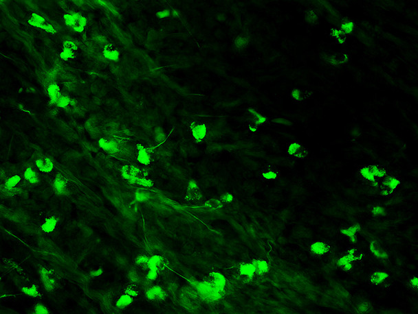 IgA Antibody with FITC Tag (1ml)