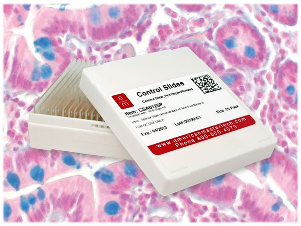 Small Intestine Control Slides