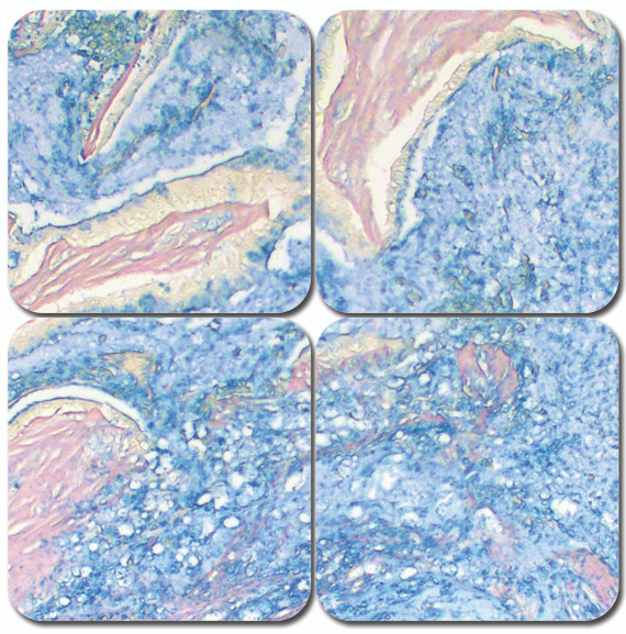 Colloidal Iron Stain Kit