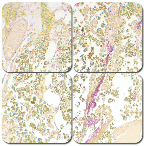 Bile Stain Kit - Halls