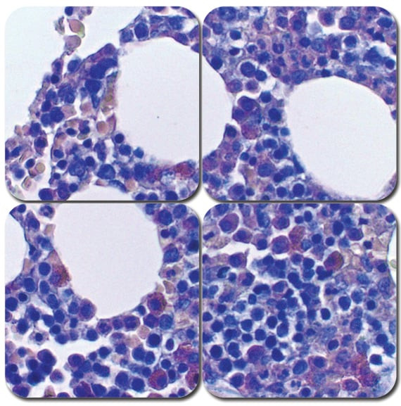Giemsa/May-Grunwald Stain Kit