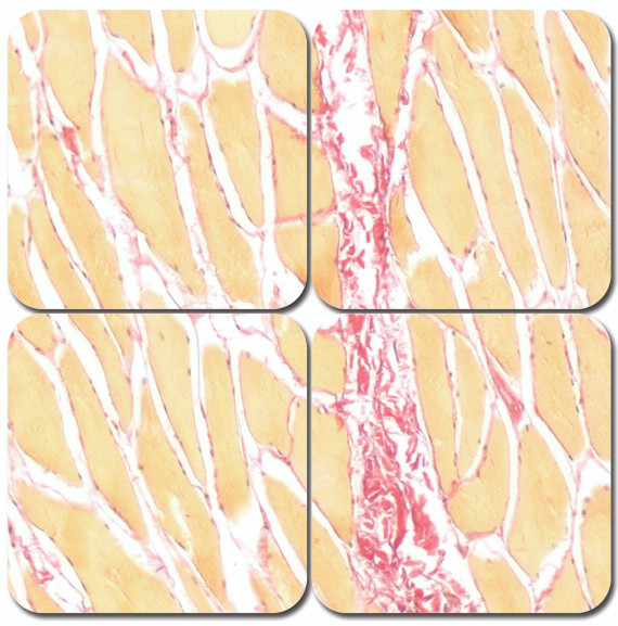 Picro-Sirius Red Pint Stain Kit, Pint