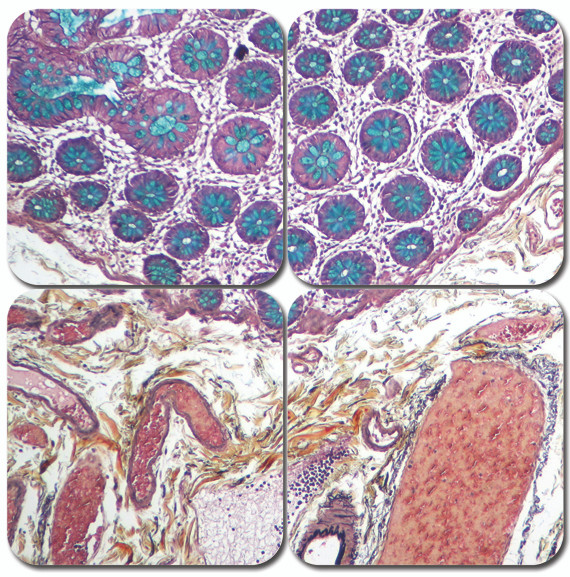 Pentachrome Stain Kit - Russell Movat