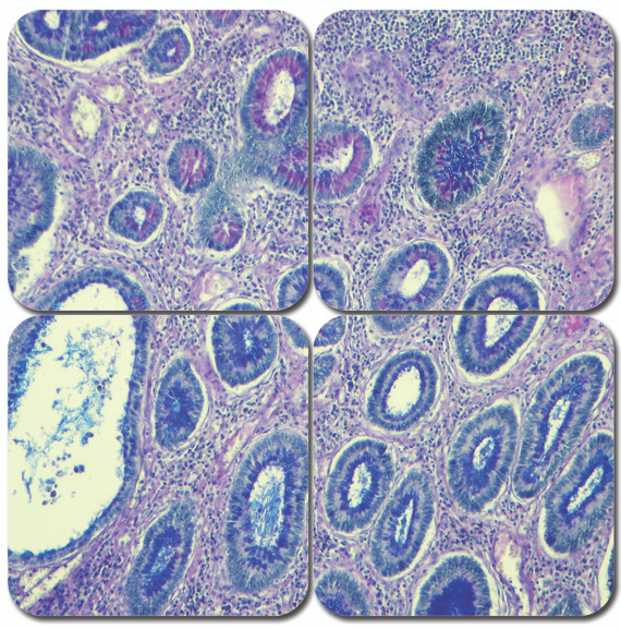 Alcian Blue PAS Stain Kit