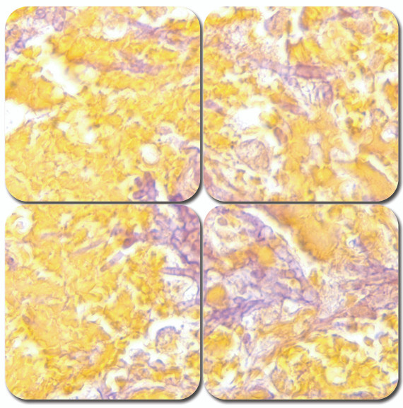 Gridley's Stain Kit, 100mL