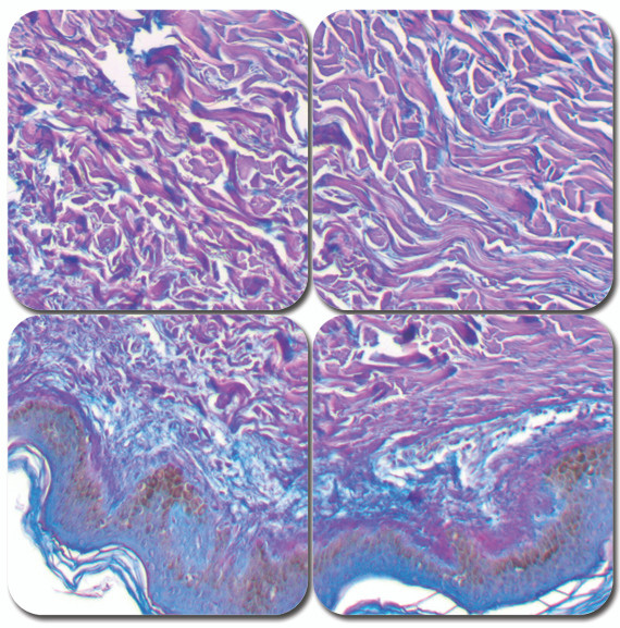 Herovici's Collagen Stain Kit
