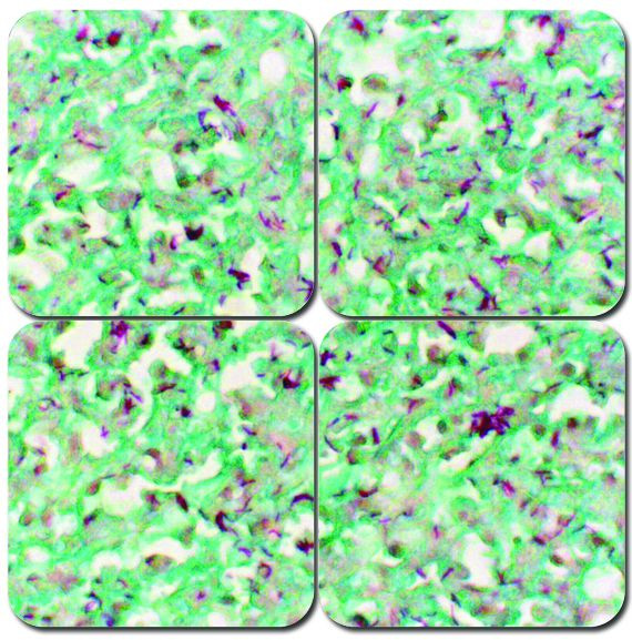 Fite's Stain Kit, Modified - Leprosy Stain