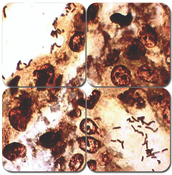 Warthin-Starry Stain Kit - Modified Stat