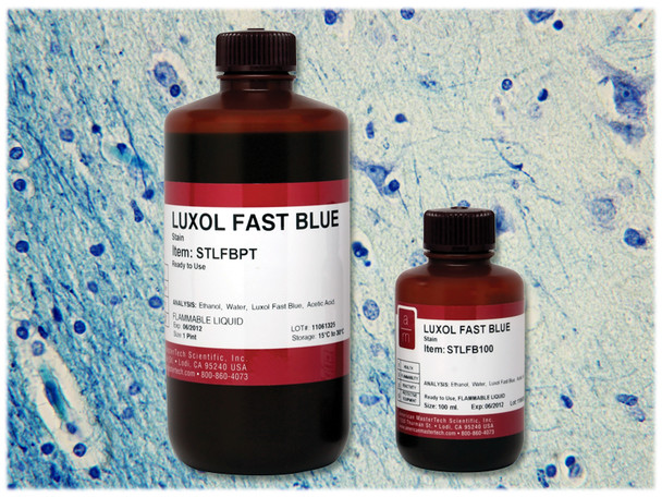 Luxol Fast Blue Stain