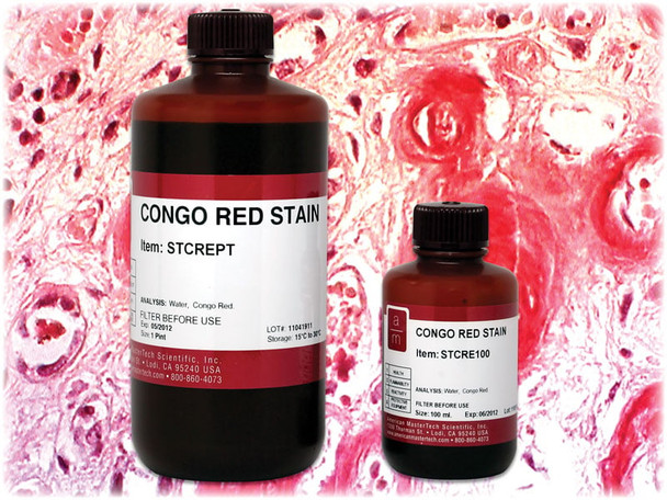 Congo Red Stain