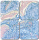 Colloidal Iron Stain Kit