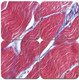 Trichrome Stain Kit - Masson's