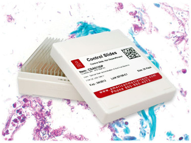 Nocardia Control Slides