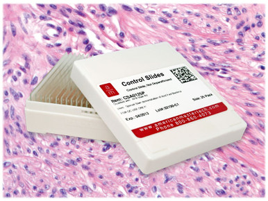 StatLab Uterus Control Slides, adhesive slide. 25 slides / box