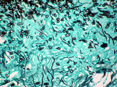StatLab HCS Fungus Control Slides, adhesive slide