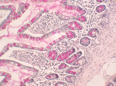 StatLab HCS Mucicarmine Control Slides, adhesive slide