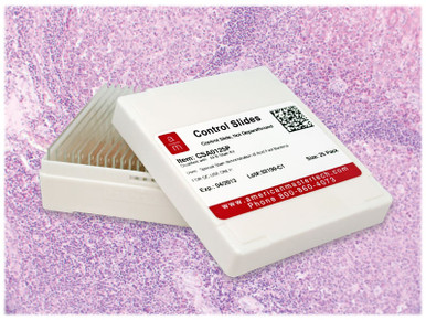 Tonsil IHC Control Slides