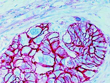 CD44/H-CAM, Clone 156-3C11