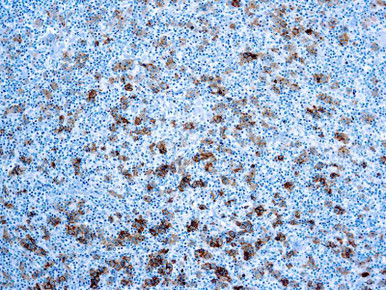CD30/Ki-1, Clone Ber-H2, 10mL