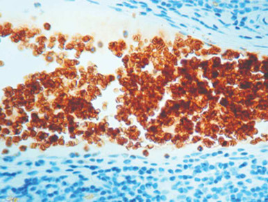 Glycophorin A, Clone JC159