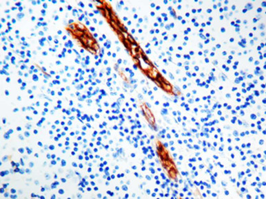 Factor VIII Related Antigen/V, Clone F8/86