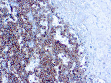 CD99/MIC2, Ewing’s Sarcoma Marker, Clone HO36-1.1, 10mL