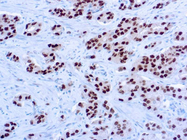 Androgen Receptor (AR), Clone AR 441