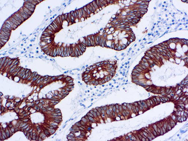 CK5 Cytokeratin 5, Clone XM26