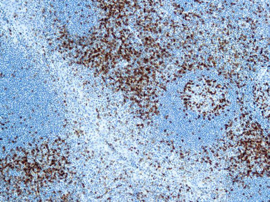 CD45 LCA, Clone 2B11+PD7/26, 10mL