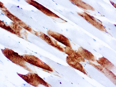 Myosin, Skeletal (Fast), Clone MY32, 10ml