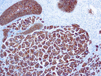 Cytokeratin 7, Clone OV-TL12/30