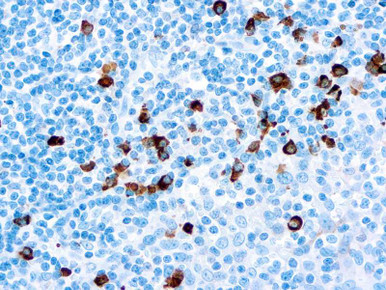 IgG Antibody, 10ml