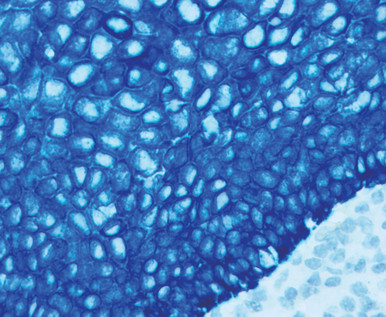 Blue AP Chromogen, Ultra High Def