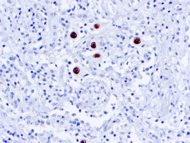 Manual Cytomegalovirus (CMV Cocktail) ASR