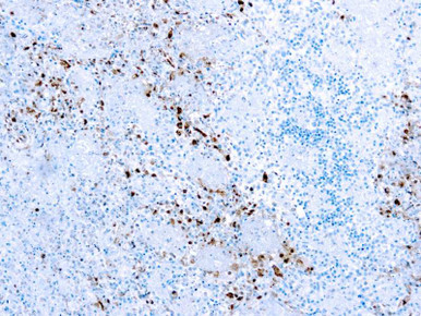 HSV1 Herpes Simplex Virus Type I, ASR, 10mL