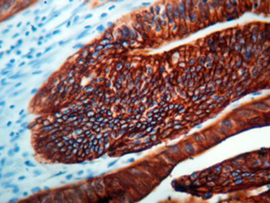 Cytokeratin 20, Clone Ks20.8