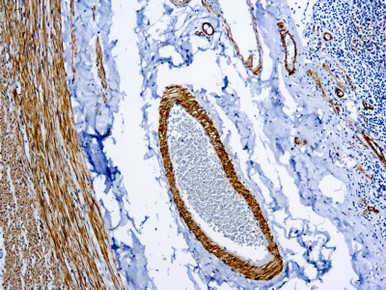 Smooth Muscle Myosin, Clone SMMS-1