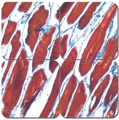 Trichrome Stain Kit - Mallory's