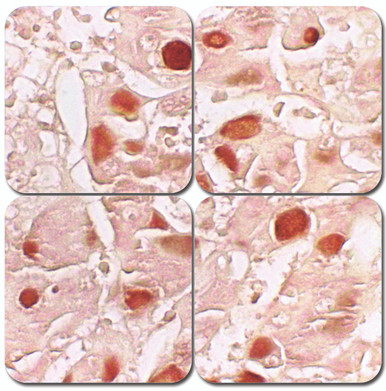 Hepatitis B Stain Kit