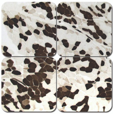 ATPase, Myofibrillar Stain Kit