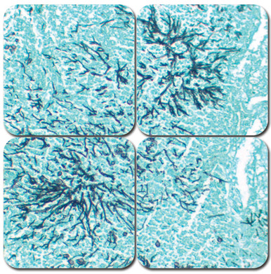 GMS Stain Kit